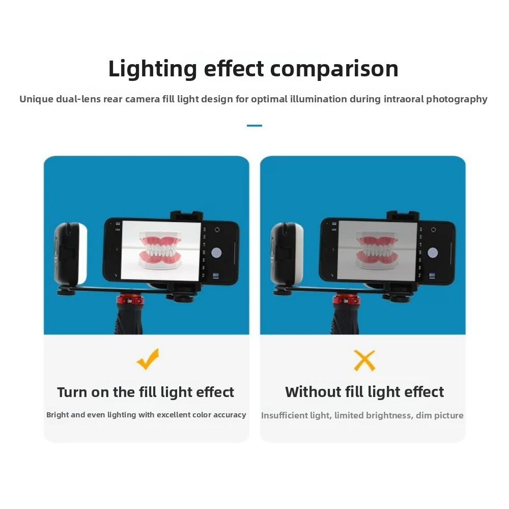 Dental Photography Light, Blue - đánh giá và giá Photography Lighting Kit